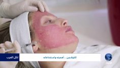 [ID: xMHBnkRnCCs] Youtube Automatic