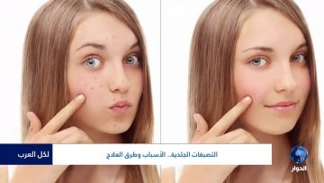 [ID: Y4oZCYQYDuE] Youtube Automatic