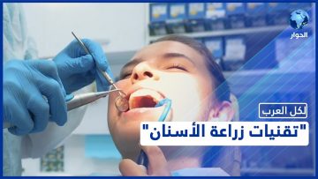 خاص: [ID: ads2bZZVBkU] Youtube Automatic