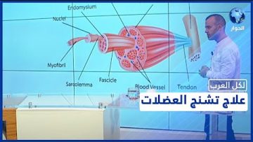 خاص: [ID: MVPjfI0sJ6A] Youtube Automatic