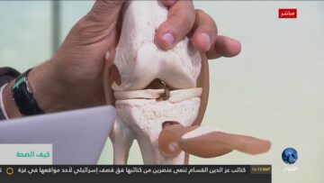 [ID: ew48yeMneFc] Youtube Automatic