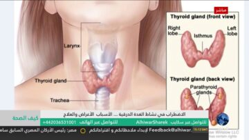 [ID: Tmmzh4vM6q8] Youtube Automatic